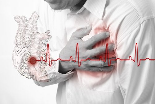 Kalp Krizi (Miyokard İnfarktüsü)
