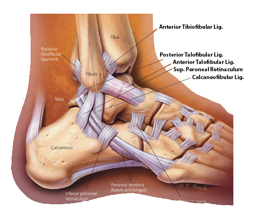 Ankle Ligament Injuries