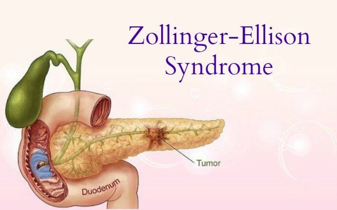 Zollinger Ellison Syndrome