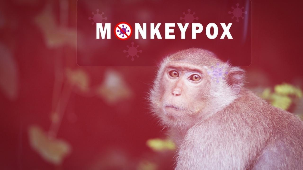 maymun-cicegi-virusu-monkeypox