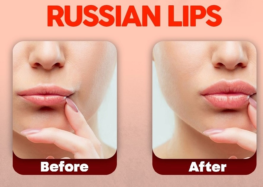 Russian Lips