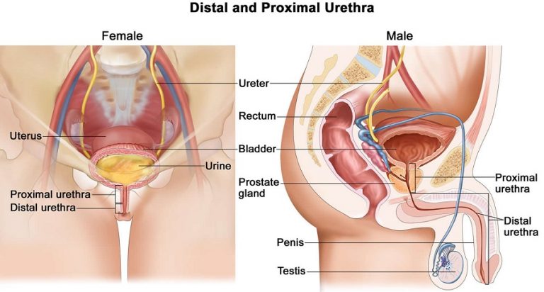 Urethritis