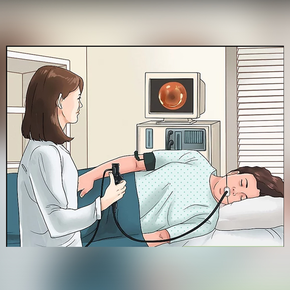 Endoscopy-Procedure