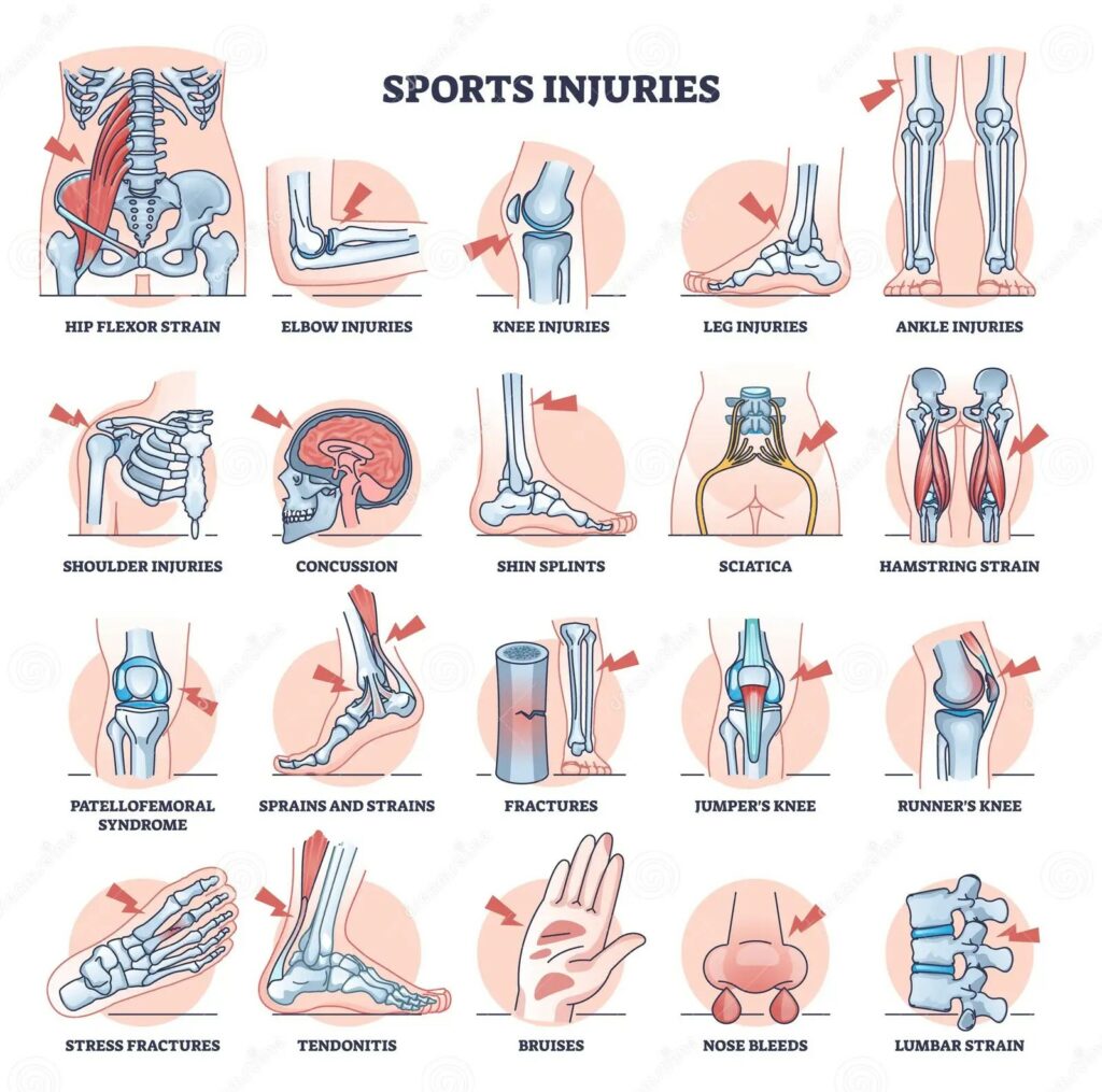 Sport Injuries