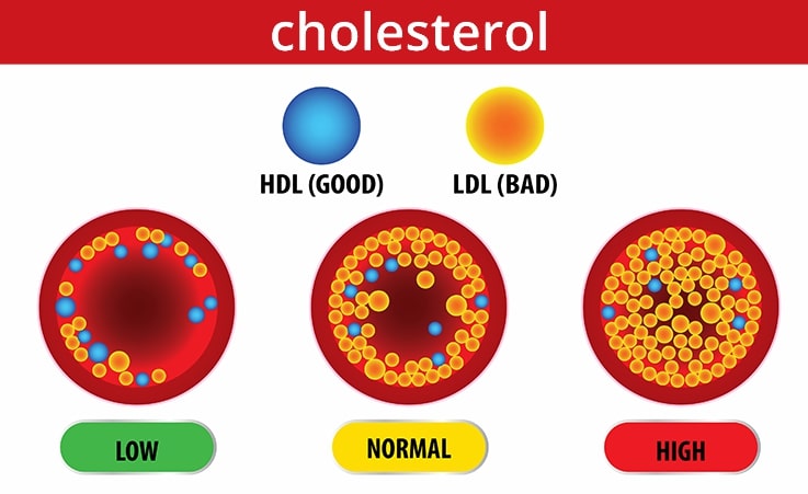 Cholesterol