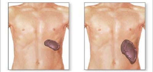 spleen